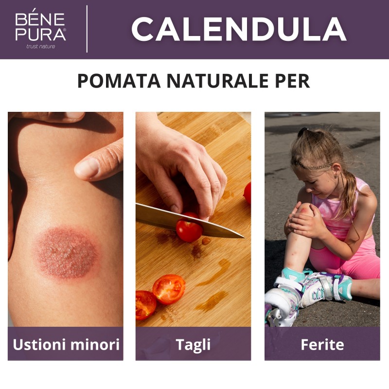 3x Pomata per Ustioni e Ferite con Calendula - 40ml