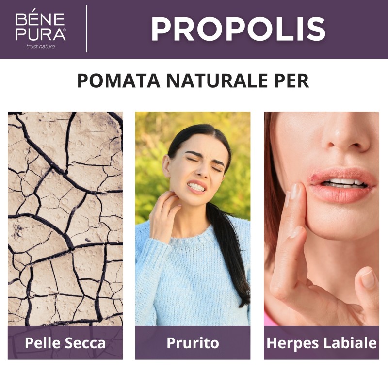 Pomata per Prurito con 30% Propoli - 40ml