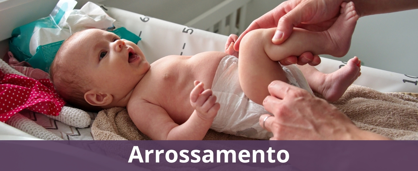 Arrossamento