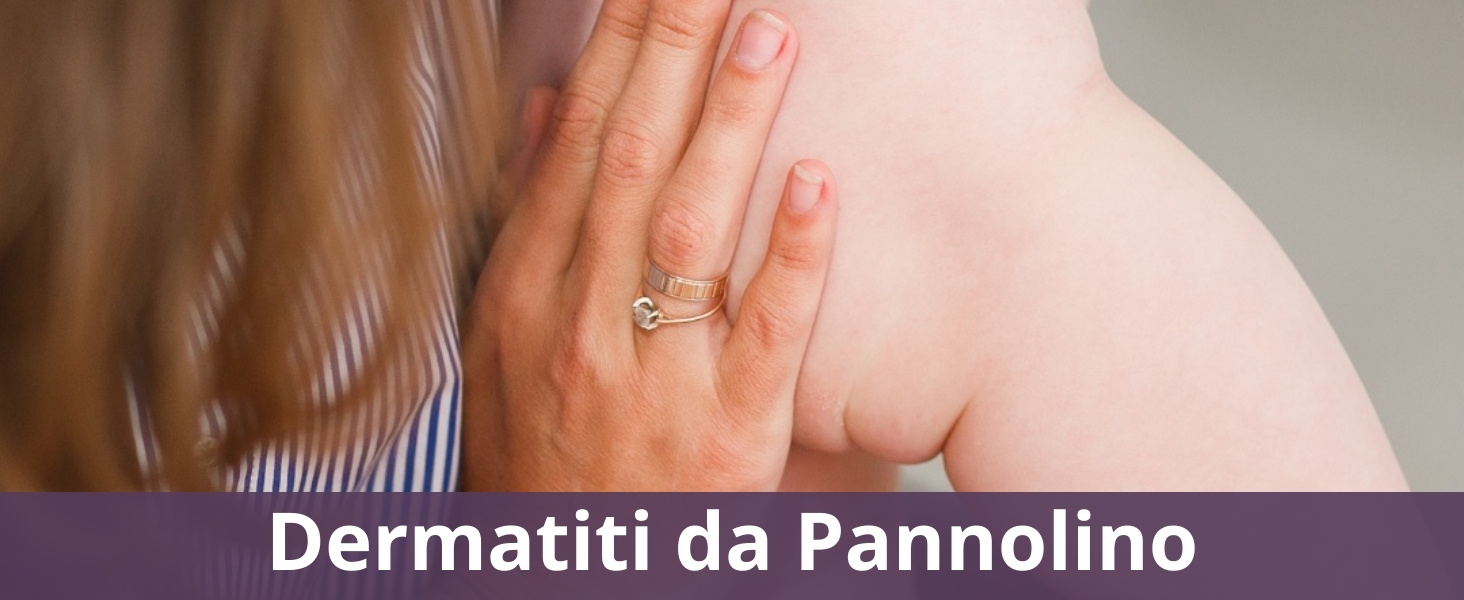 Dermatiti da Pannolino