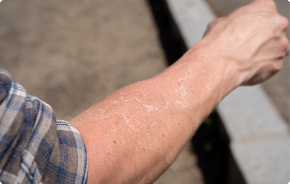 Come olio per pelli irritate e secche