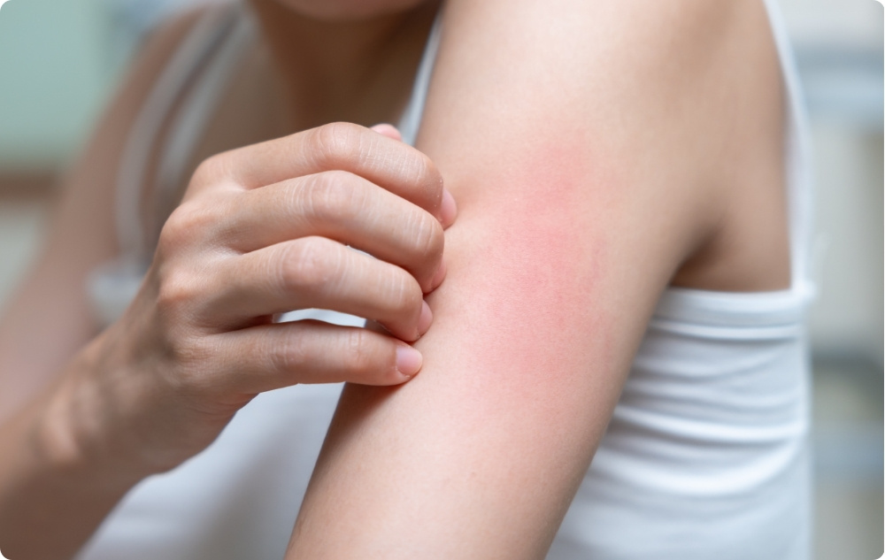 Come olio lenitivo per pelli sensibili o irritate