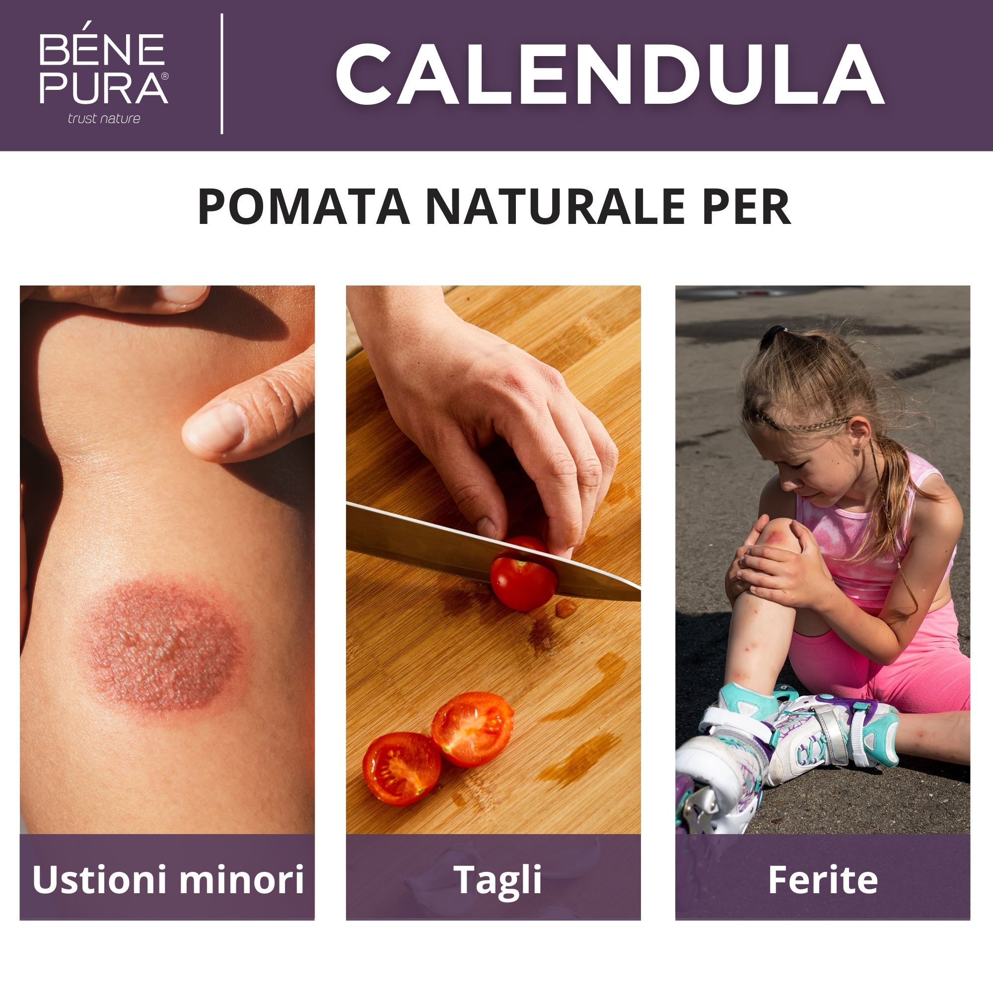 Pomata per Ustioni e Ferite con Calendula, Aloe Vera ed Erba di San Giovanni - 40ml